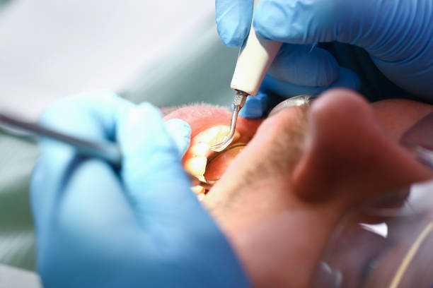 Best Broken or Chipped Tooth Repair in Davis Junction, IL